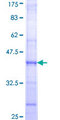 FGF17 Protein - 12.5% SDS-PAGE Stained with Coomassie Blue.