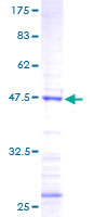 FGF18 Protein - 12.5% SDS-PAGE of human FGF18 stained with Coomassie Blue