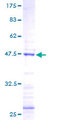 FGF18 Protein - 12.5% SDS-PAGE of human FGF18 stained with Coomassie Blue