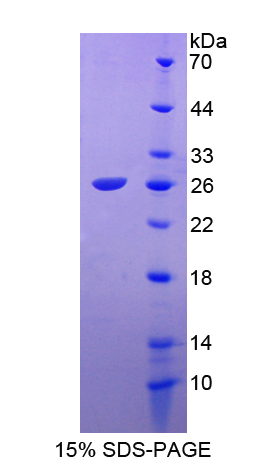 FGF18 Protein - Recombinant  Fibroblast Growth Factor 18 By SDS-PAGE