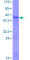 FGF19 Protein - 12.5% SDS-PAGE of human FGF19 stained with Coomassie Blue