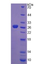 FGF19 Protein - Recombinant Fibroblast Growth Factor 19 By SDS-PAGE