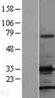 FGF2 / Basic FGF Protein - Western validation with an anti-DDK antibody * L: Control HEK293 lysate R: Over-expression lysate