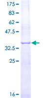 FGF2 / Basic FGF Protein - 12.5% SDS-PAGE Stained with Coomassie Blue.