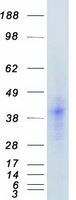 FGF2 / Basic FGF Protein - Purified recombinant protein FGF2 was analyzed by SDS-PAGE gel and Coomassie Blue Staining