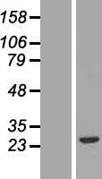FGF20 Protein - Western validation with an anti-DDK antibody * L: Control HEK293 lysate R: Over-expression lysate