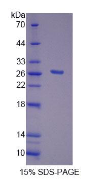 FGF20 Protein - Recombinant Fibroblast Growth Factor 20 (FGF20) by SDS-PAGE