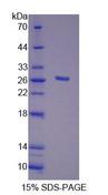 FGF20 Protein - Recombinant Fibroblast Growth Factor 20 (FGF20) by SDS-PAGE