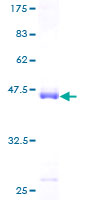 FGF21 Protein - 12.5% SDS-PAGE of human FGF21 stained with Coomassie Blue