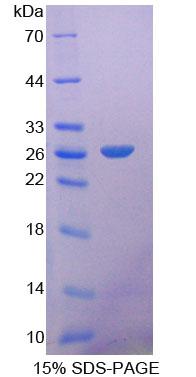 FGF21 Protein - Recombinant Fibroblast Growth Factor 21 By SDS-PAGE