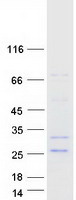 FGF21 Protein - Purified recombinant protein FGF21 was analyzed by SDS-PAGE gel and Coomassie Blue Staining