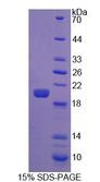 FGF22 Protein - Recombinant Fibroblast Growth Factor 22 (FGF22) by SDS-PAGE