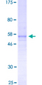 FGF23 Protein - 12.5% SDS-PAGE of human FGF23 stained with Coomassie Blue