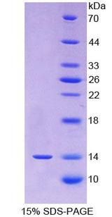 FGF23 Protein - Recombinant Fibroblast Growth Factor 23 By SDS-PAGE