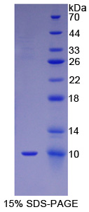 FGF3 Protein - Recombinant Fibroblast Growth Factor 3 By SDS-PAGE