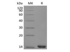 FGF4 Protein - Recombinant Human FGF-4