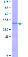 FGF5 Protein - 12.5% SDS-PAGE of human FGF5 stained with Coomassie Blue