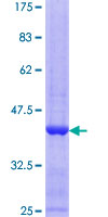 FGF5 Protein - 12.5% SDS-PAGE Stained with Coomassie Blue.