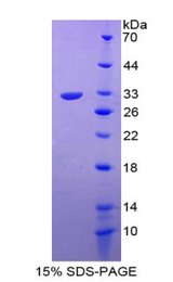 FGF5 Protein - Recombinant Fibroblast Growth Factor 5 By SDS-PAGE