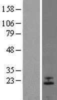 FGF6 Protein - Western validation with an anti-DDK antibody * L: Control HEK293 lysate R: Over-expression lysate