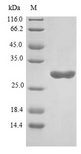 FGF7 / KGF Protein - (Tris-Glycine gel) Discontinuous SDS-PAGE (reduced) with 5% enrichment gel and 15% separation gel.