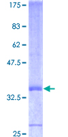 FGF7 / KGF Protein - 12.5% SDS-PAGE of human FGF7 stained with Coomassie Blue