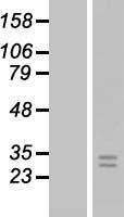 FGF8 Protein - Western validation with an anti-DDK antibody * L: Control HEK293 lysate R: Over-expression lysate