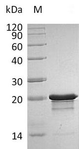 FGF8 Protein - (Tris-Glycine gel) Discontinuous SDS-PAGE (reduced) with 5% enrichment gel and 15% separation gel.