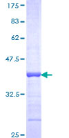 FGF9 Protein - 12.5% SDS-PAGE Stained with Coomassie Blue.