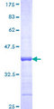 FGF9 Protein - 12.5% SDS-PAGE Stained with Coomassie Blue.