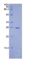 FGF9 Protein - Recombinant Fibroblast Growth Factor 9 By SDS-PAGE