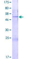 FGFBP2 Protein - 12.5% SDS-PAGE of human FGFBP2 stained with Coomassie Blue