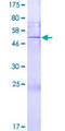 FGFBP2 Protein - 12.5% SDS-PAGE of human FGFBP2 stained with Coomassie Blue