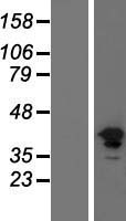 FGFR1 / FGF Receptor 1 Protein - Western validation with an anti-DDK antibody * L: Control HEK293 lysate R: Over-expression lysate