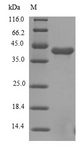 FGFR1 / FGF Receptor 1 Protein - (Tris-Glycine gel) Discontinuous SDS-PAGE (reduced) with 5% enrichment gel and 15% separation gel.
