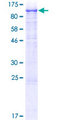 FGFR1 / FGF Receptor 1 Protein - 12.5% SDS-PAGE of human FGFR1 stained with Coomassie Blue