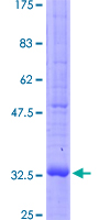 FGFR1 / FGF Receptor 1 Protein - 12.5% SDS-PAGE Stained with Coomassie Blue.