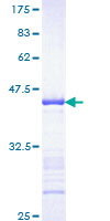 FGFR1 / FGF Receptor 1 Protein - 12.5% SDS-PAGE Stained with Coomassie Blue.