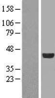 FGFR1OP / FOP Protein - Western validation with an anti-DDK antibody * L: Control HEK293 lysate R: Over-expression lysate