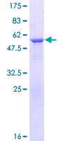 FGFR1OP2 Protein - 12.5% SDS-PAGE of human FGFR1OP2 stained with Coomassie Blue