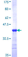 FGFR1OP2 Protein - 12.5% SDS-PAGE Stained with Coomassie Blue.