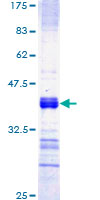 FGFR2 / FGF Receptor 2 Protein - 12.5% SDS-PAGE Stained with Coomassie Blue.