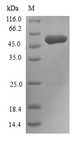 FGFR3 Protein - (Tris-Glycine gel) Discontinuous SDS-PAGE (reduced) with 5% enrichment gel and 15% separation gel.