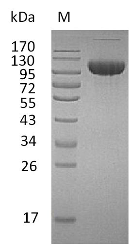 FGFR3 Protein - (Tris-Glycine gel) Discontinuous SDS-PAGE (reduced) with 5% enrichment gel and 15% separation gel.