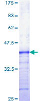 FGFR3 Protein - 12.5% SDS-PAGE Stained with Coomassie Blue.