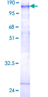 FGFR4 Protein - 12.5% SDS-PAGE of human FGFR4 stained with Coomassie Blue