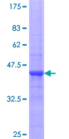 FGFR4 Protein - 12.5% SDS-PAGE Stained with Coomassie Blue.