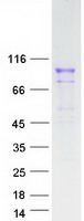 FGFR4 Protein - Purified recombinant protein FGFR4 was analyzed by SDS-PAGE gel and Coomassie Blue Staining