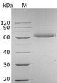 FGFRL1 Protein - (Tris-Glycine gel) Discontinuous SDS-PAGE (reduced) with 5% enrichment gel and 15% separation gel.