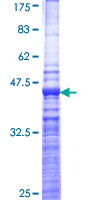 FGFRL1 Protein - 12.5% SDS-PAGE Stained with Coomassie Blue.